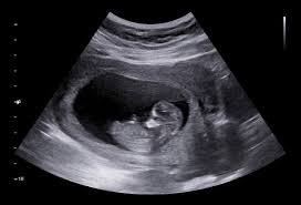 Ultrasound 2D Klinikal